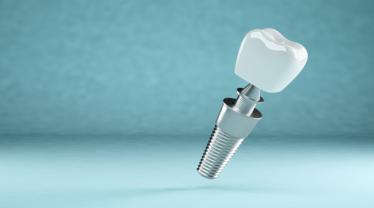Implante de dente